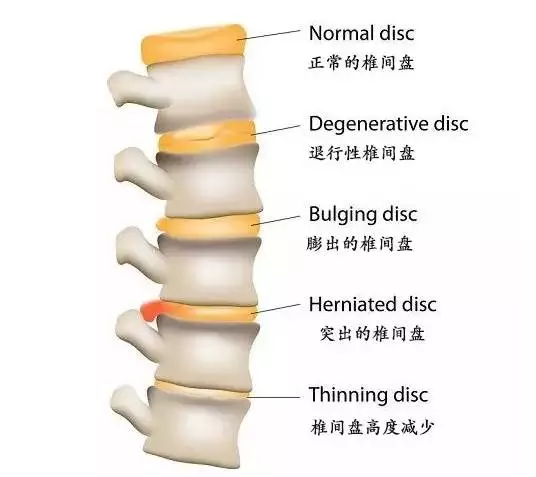 瑜伽瘦腿長(zhǎng)高，現(xiàn)在開(kāi)始練還不遲