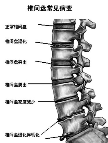 練習(xí)瑜伽腰疼，瑜伽老師該怎么應(yīng)對？