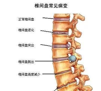 脊椎理療瑜伽的好處